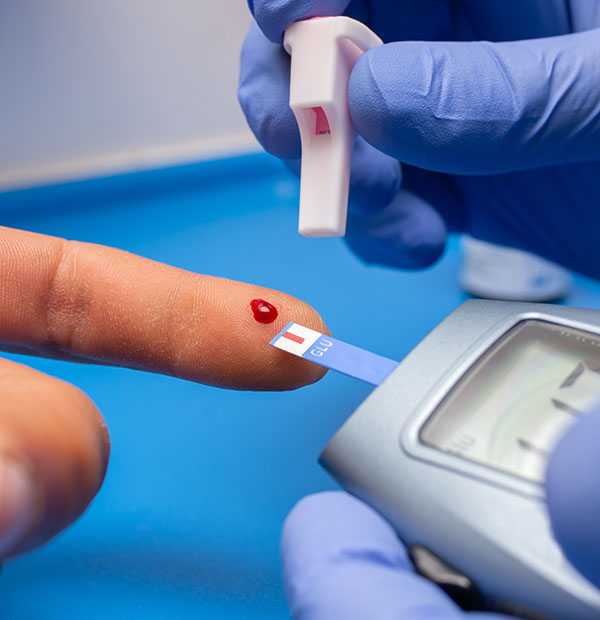 Blood Sugar Monitoring